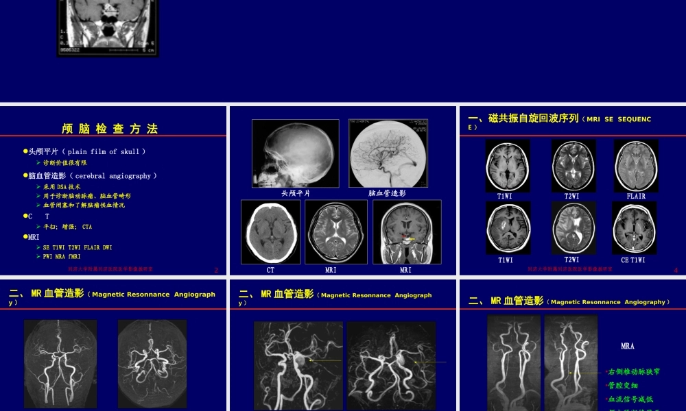 神经影像学--颅脑检查方法[1].ppt