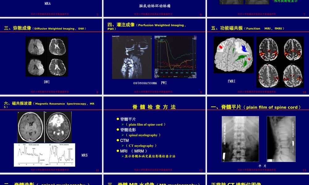 神经影像学--颅脑检查方法[1].ppt