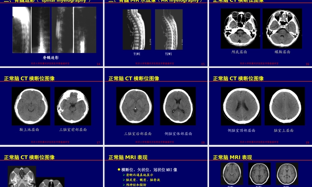 神经影像学--颅脑检查方法[1].ppt