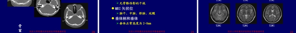 神经影像学--颅脑检查方法[1].ppt
