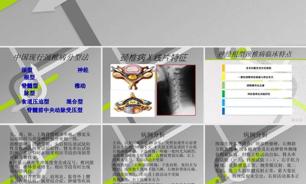 神经根性颈椎病.ppt