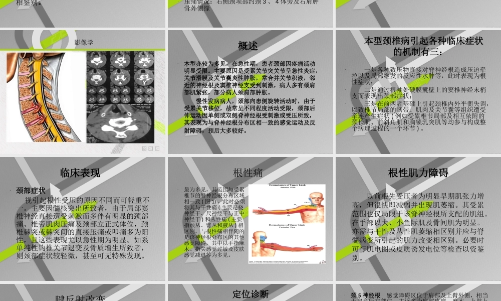 神经根性颈椎病.ppt