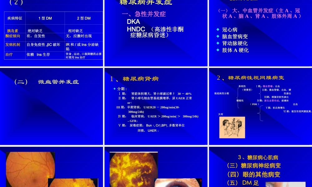 糖尿病及其并发症的诊治进展.ppt