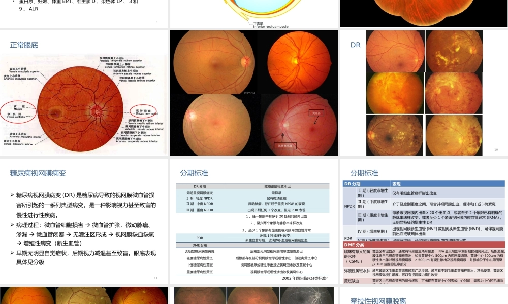 糖尿病性视网膜病变.pptx