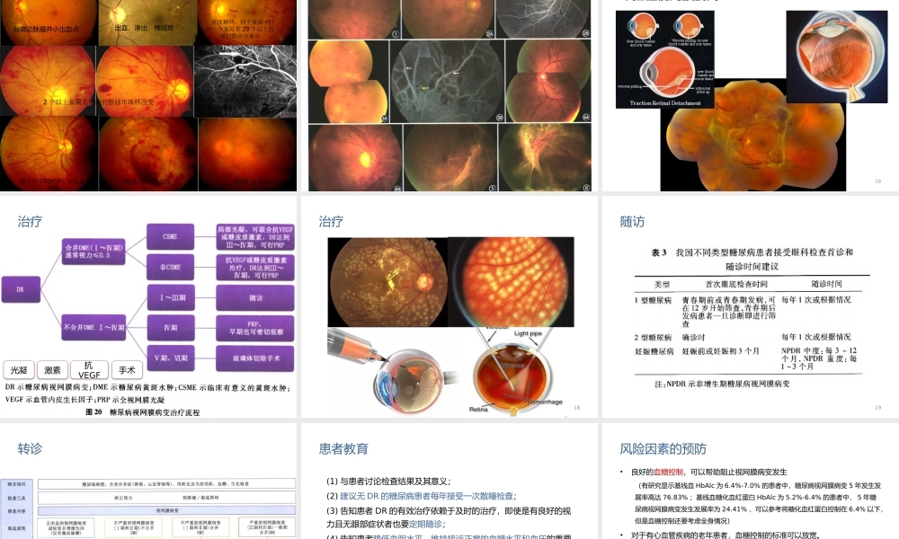 糖尿病性视网膜病变.pptx