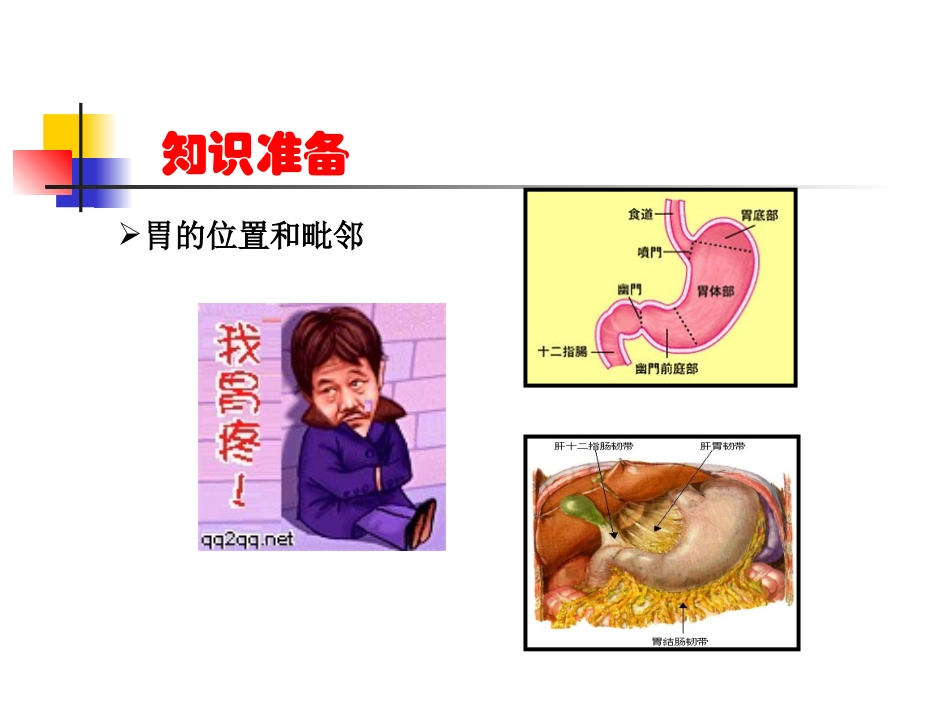 胃肠外科常见手术术式.ppt_第3页