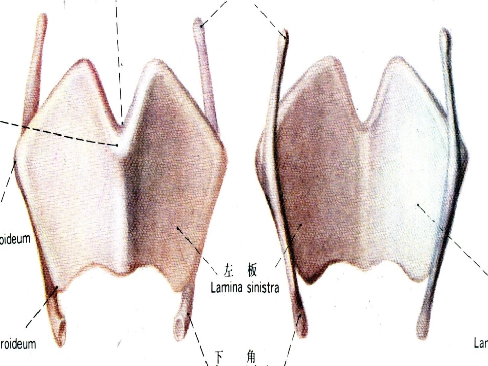 胸片广医一院.ppt_第3页