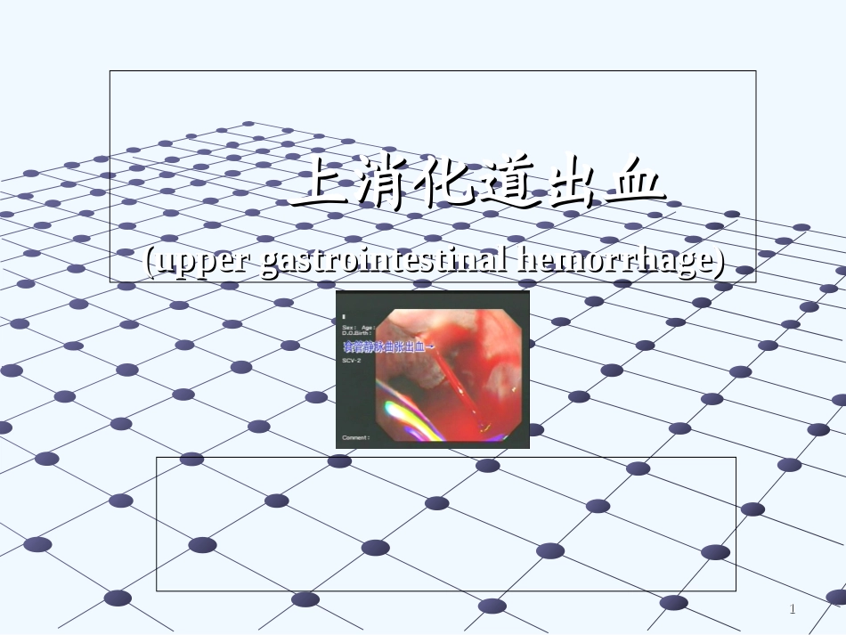 消化道出血(讲课用).ppt_第1页