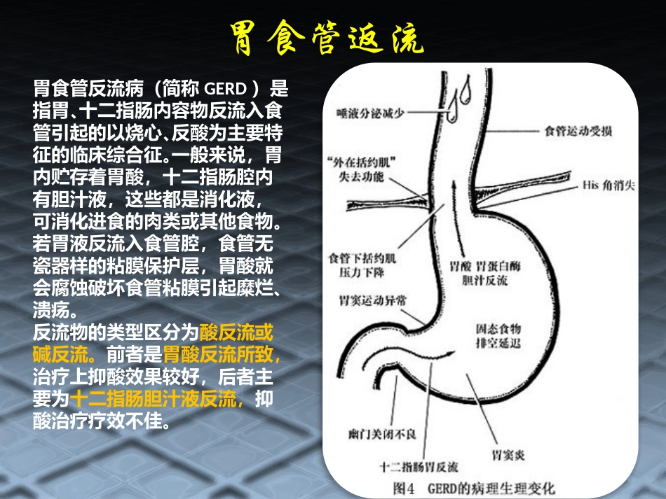 消化系统常见病及用药.pptx_第3页