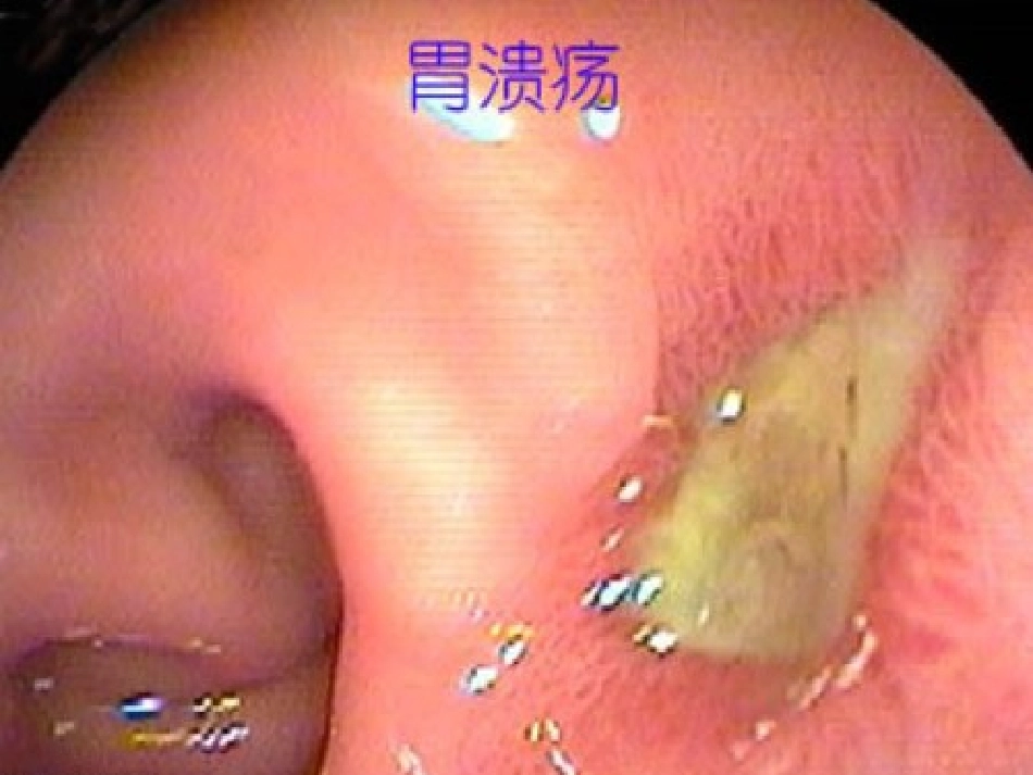 消化系统药用植物.ppt_第2页
