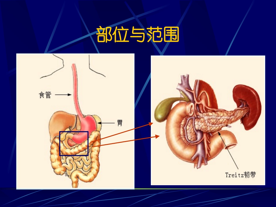 消化道出血-急诊学.ppt_第3页