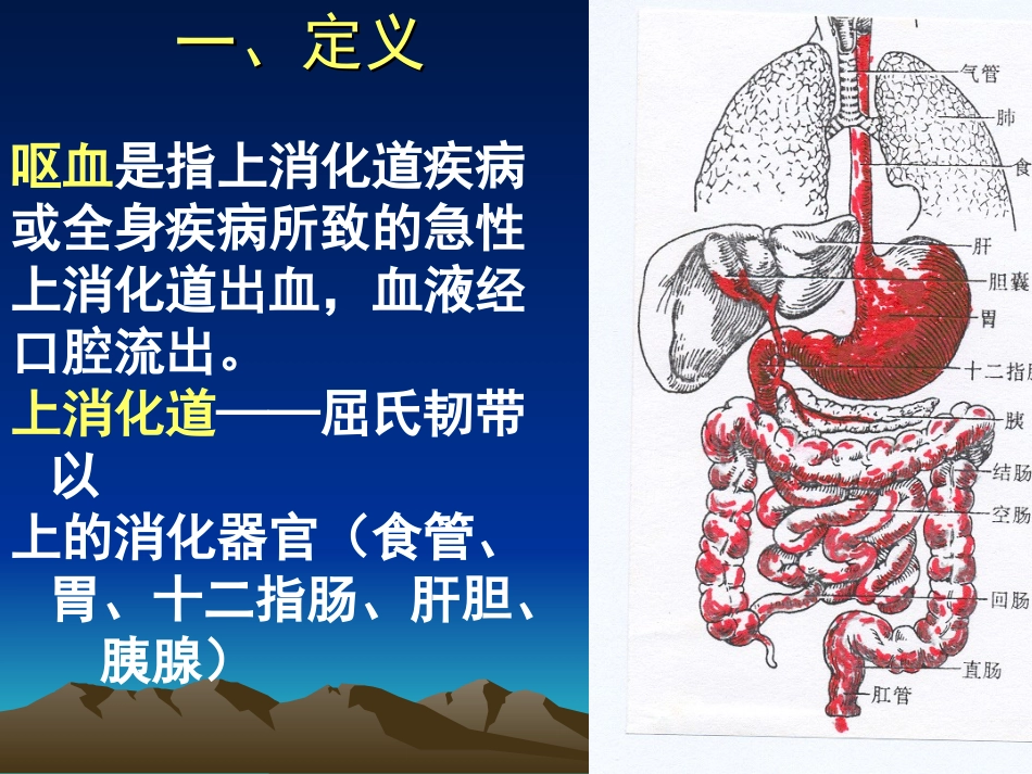 消化道出血诊疗.ppt_第2页