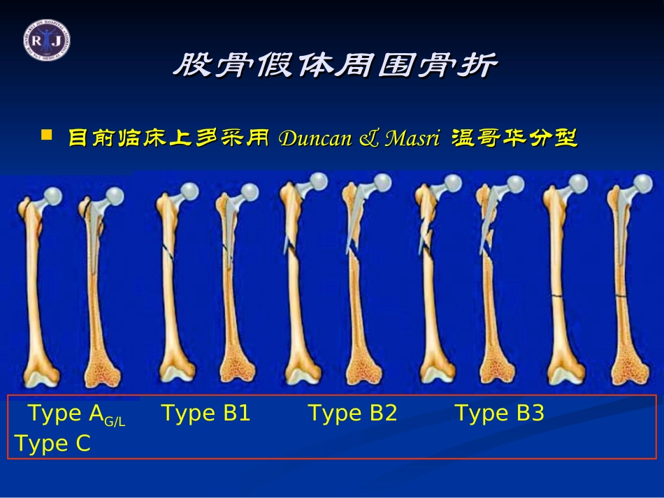 温哥华B3型股骨假体周围骨折.ppt_第3页