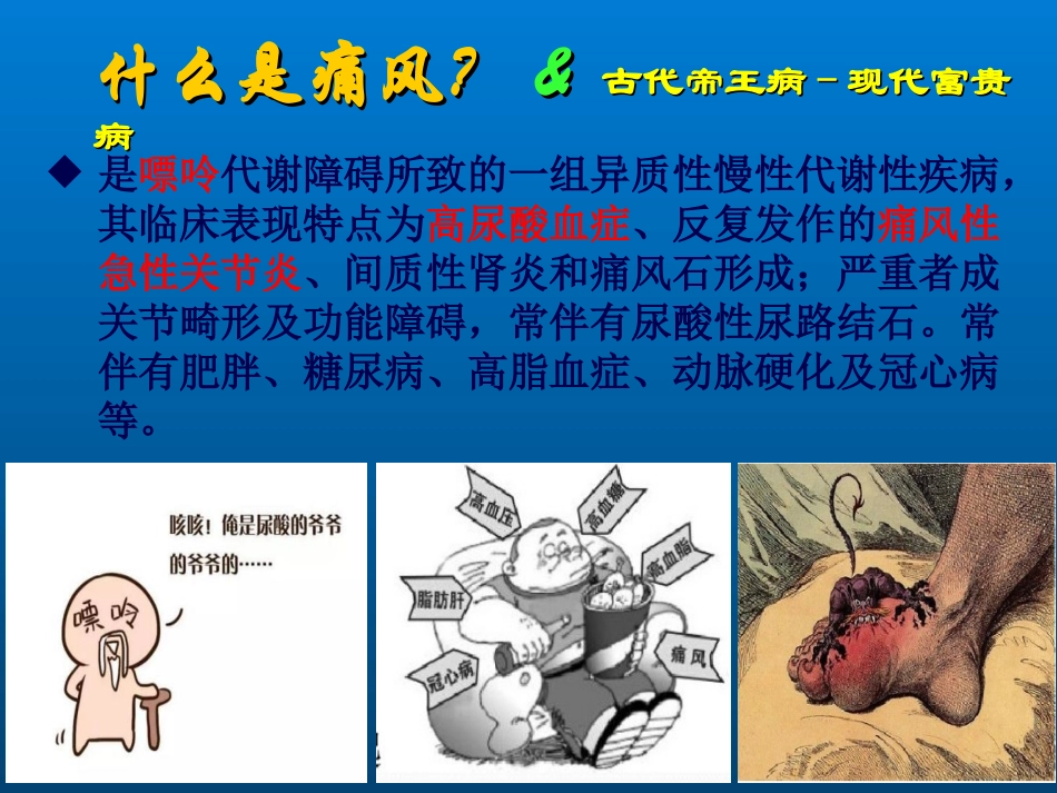痛风科普PPT.ppt_第2页