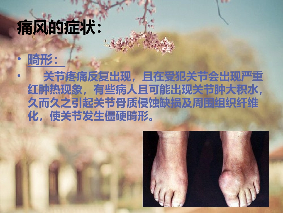 痛风的症状有哪些.ppt_第3页