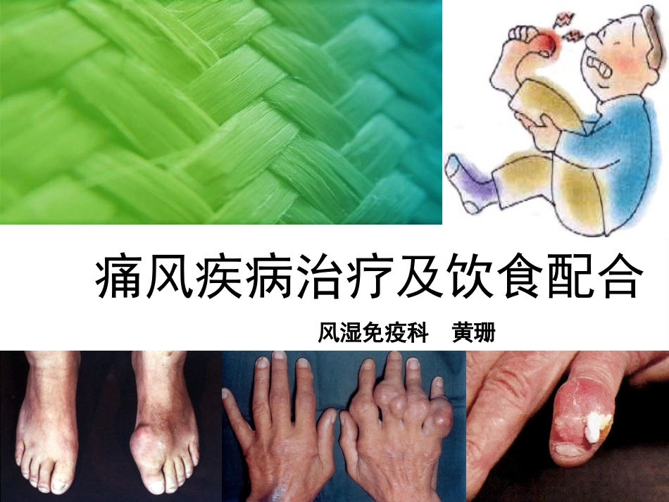 痛风-(黄珊).ppt_第1页