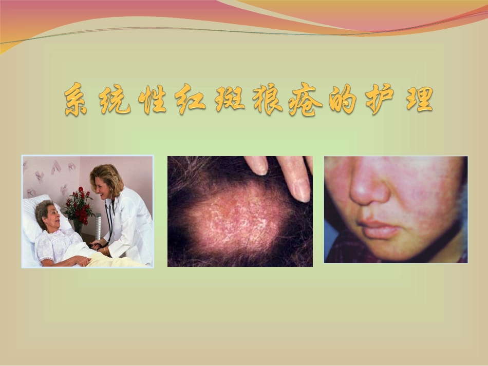 系统性红狼疮教学查房.ppt_第1页