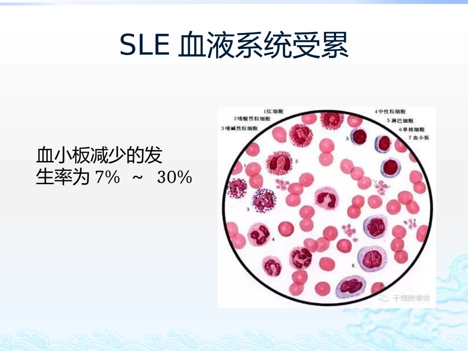 系统性红斑狼疮相关血小板减少.pptx_第3页