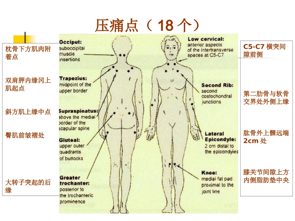 纤维肌痛综合征.ppt_第3页