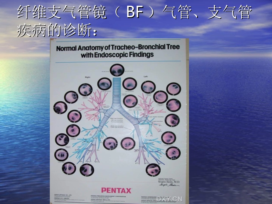 纤维支气管镜在胸外科的应用.ppt_第3页