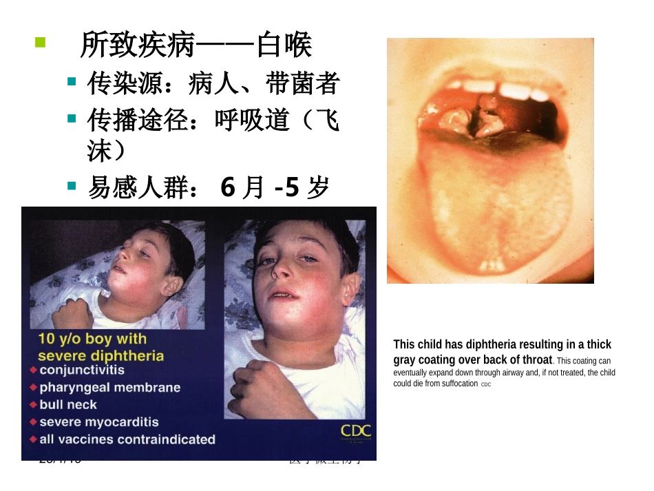 细菌附着纤毛上皮细胞.ppt_第3页