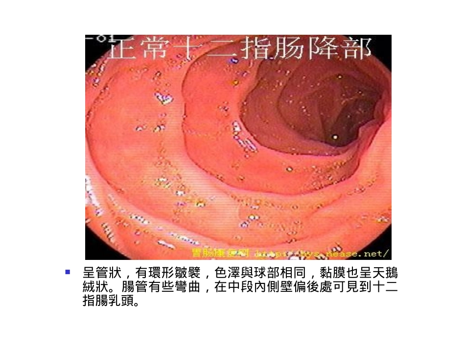 胃与十二指肠溃疡病的.ppt_第3页