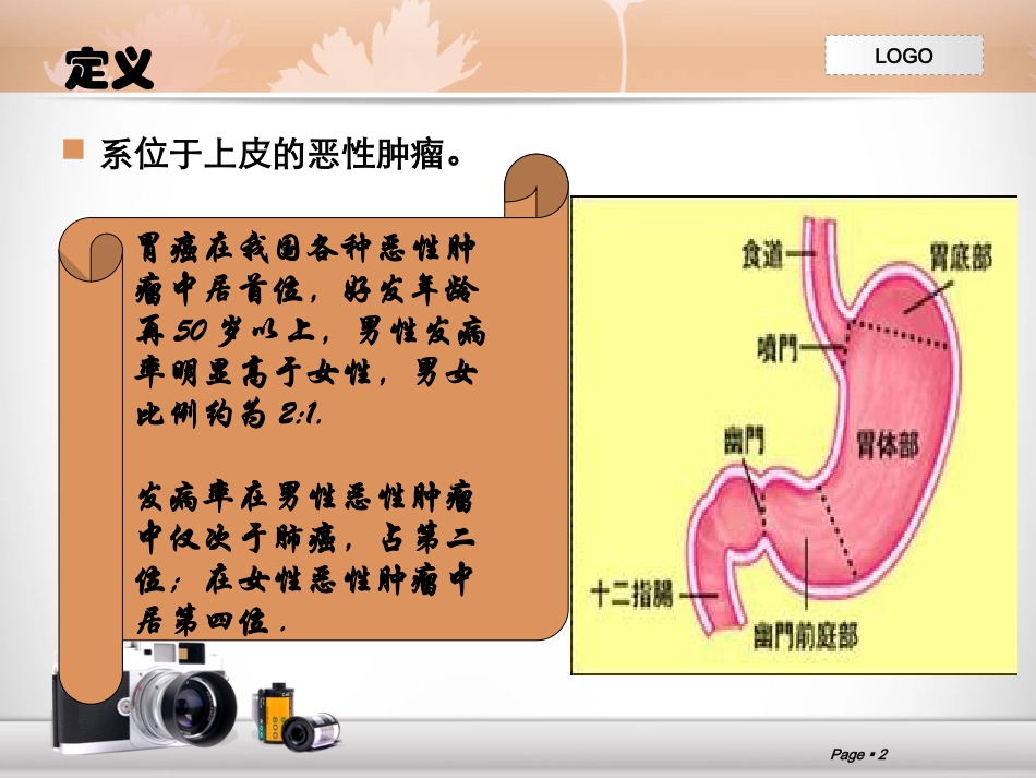 胃癌查房.ppt_第2页