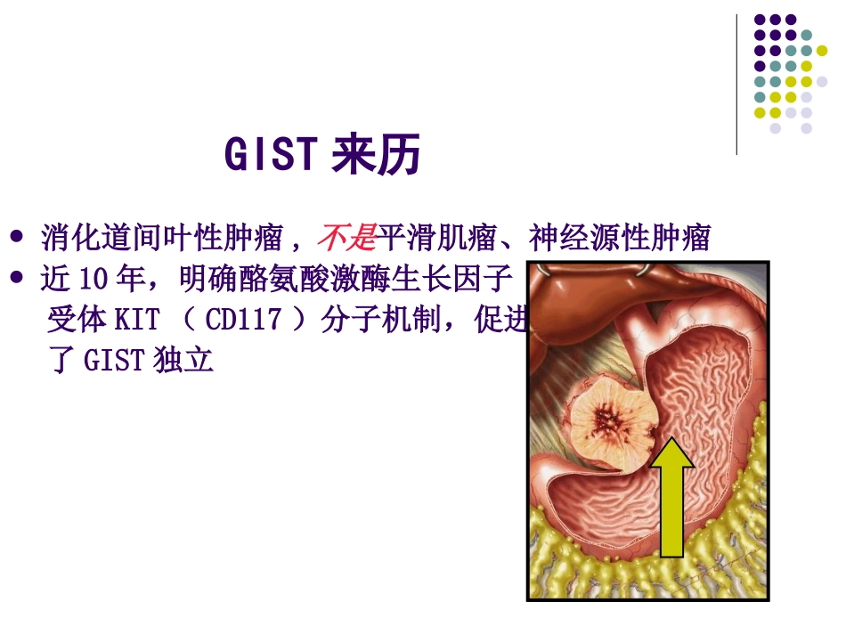 胃肠间质瘤(GIST).ppt_第3页