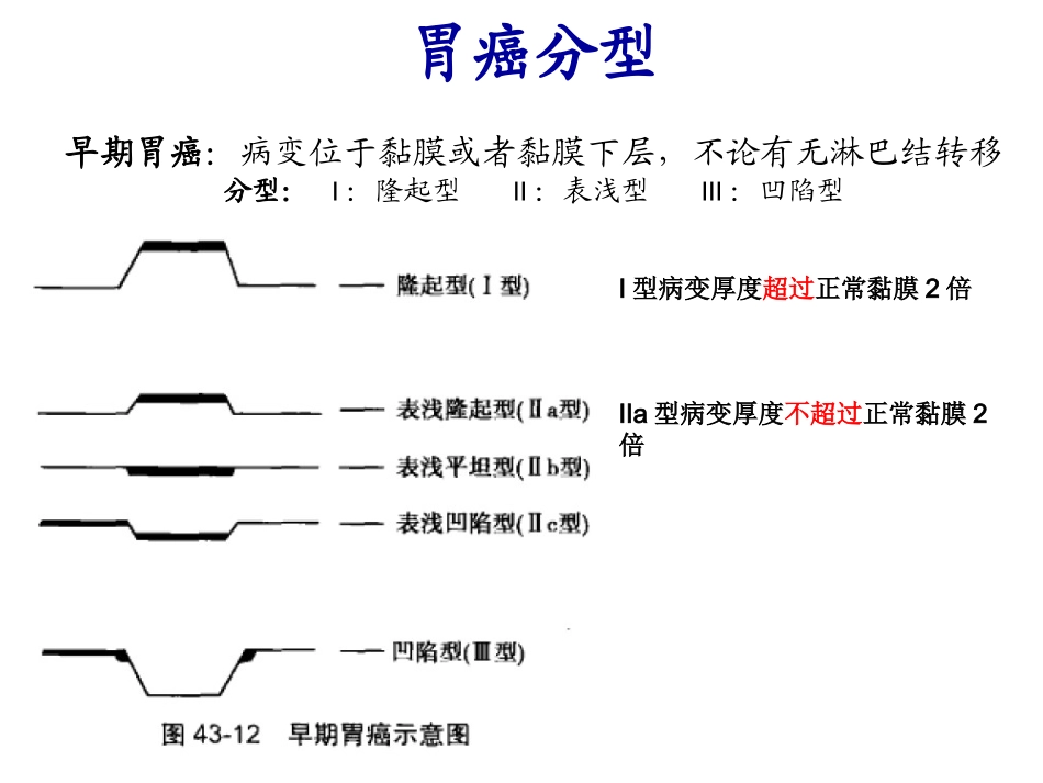 胃癌手术方式简介-淋巴结分区.pptx_第3页