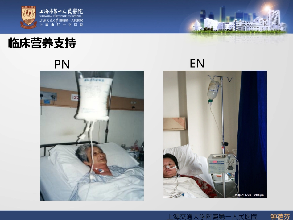 胸外科营养与代谢支持的途径的比较和选择-(2).ppt_第2页