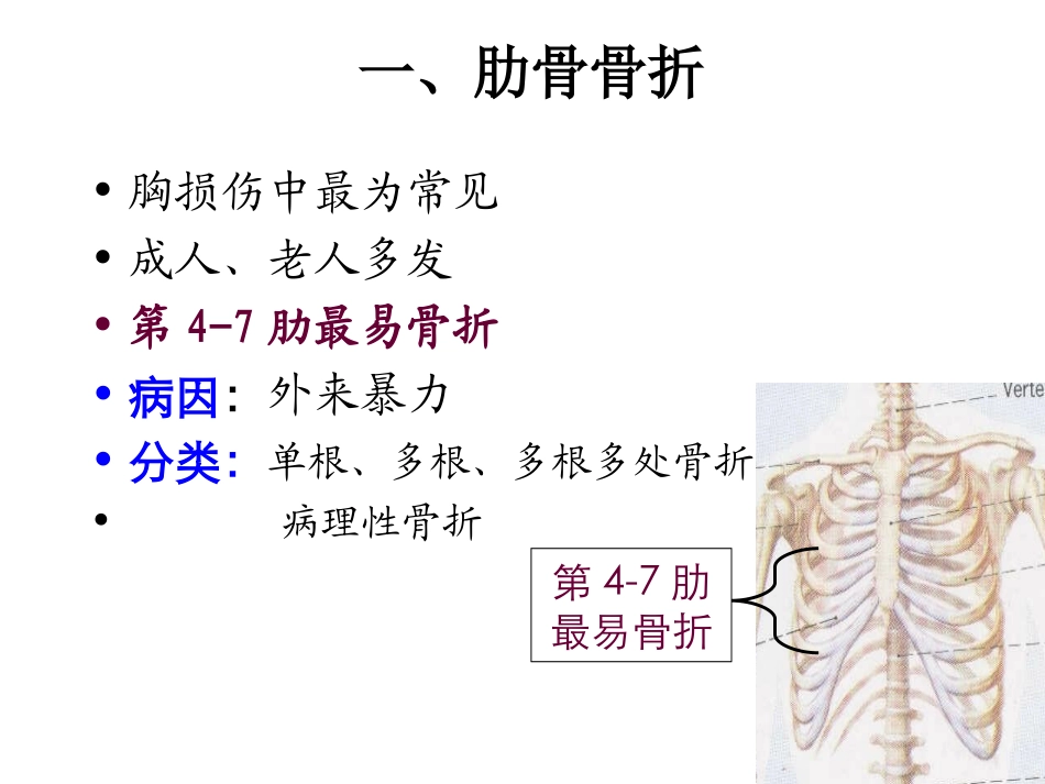 胸、腹部损伤.ppt_第2页