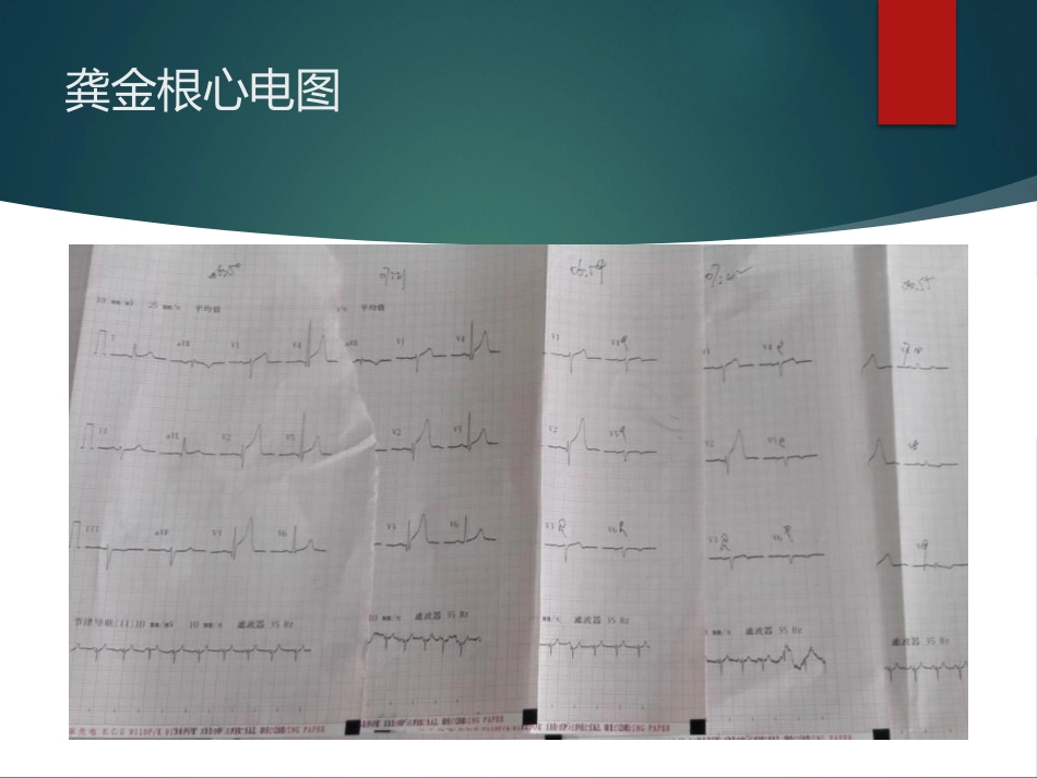 胸痛中心质量分析6.pptx_第3页