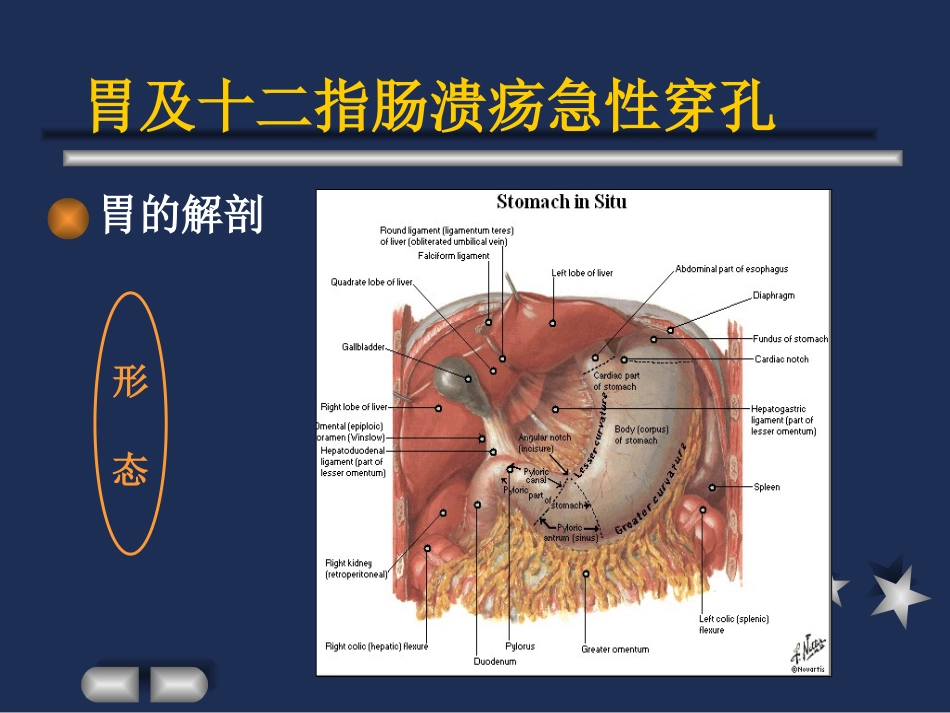胃及十二指肠溃疡急性穿孔.ppt_第3页