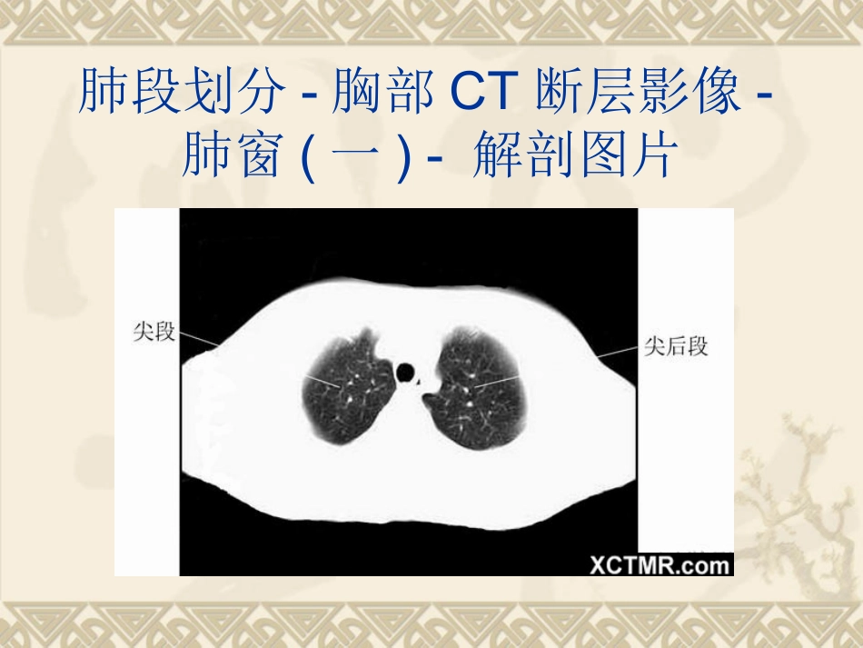 胸腹盆CT详细实用图解.ppt_第3页