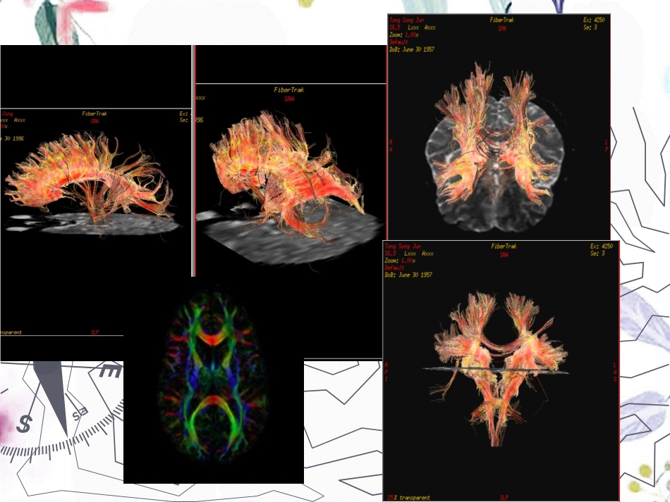 2023年DTI的基本原理及其在中枢神经系统中的应用（教学课件）.ppt_第3页