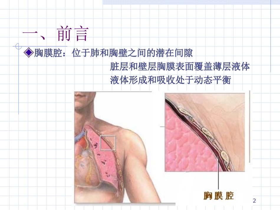 胸腔积液夏晓东-2010-2016.9.ppt_第2页
