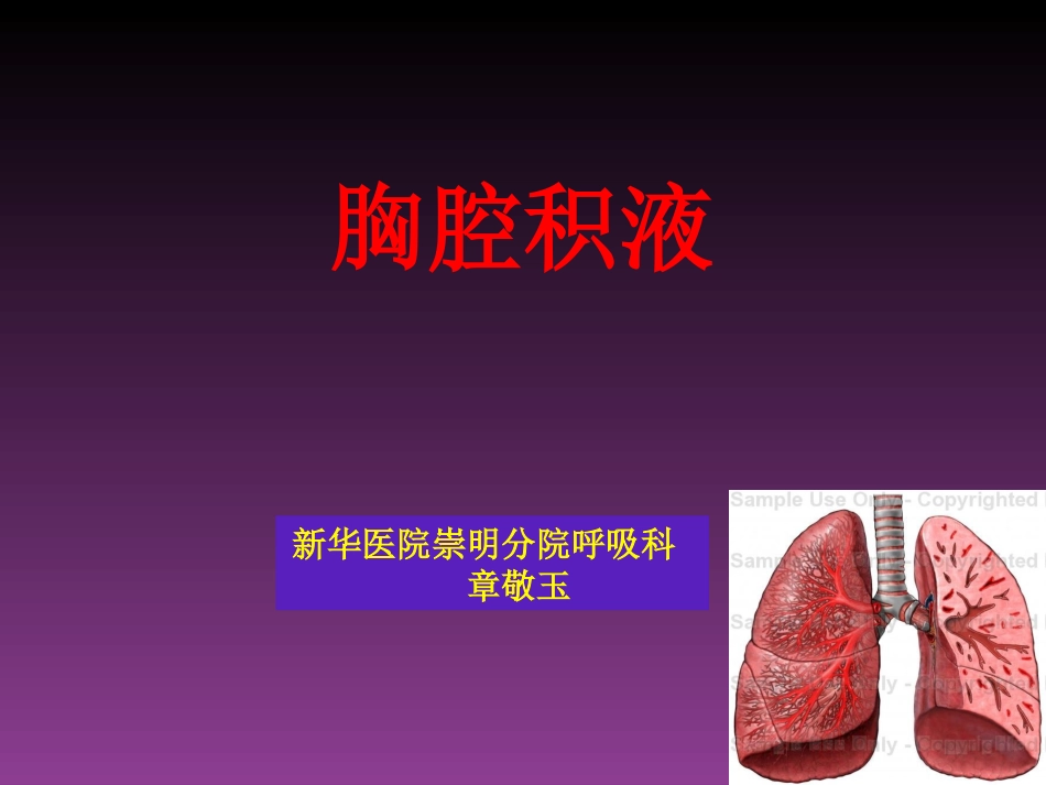胸腔积液-zjy.ppt_第1页