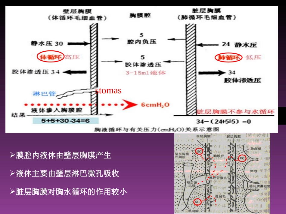 胸腔积液-zjy.ppt_第3页