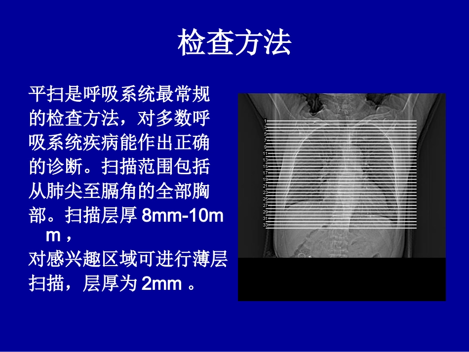 胸部CT基础知识.ppt_第3页