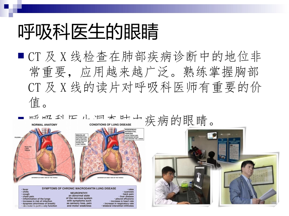 胸部CT常规读片.pptx_第3页