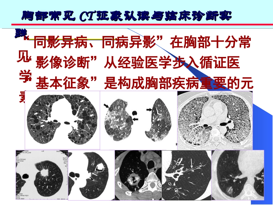 胸部常见CT征象.ppt_第2页