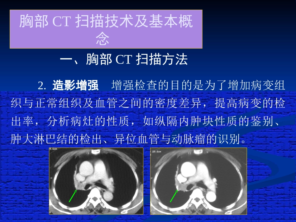 胸部正常CT读片.ppt_第3页