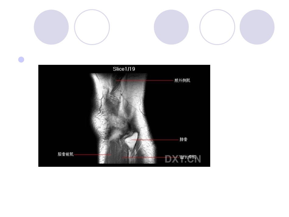膝关节MRI[1].pptb.ppt_第2页