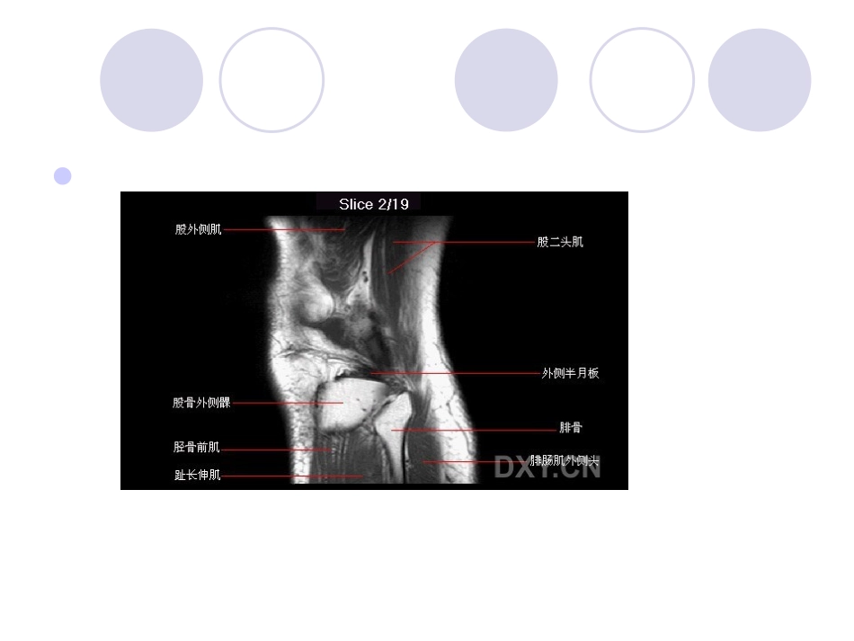 膝关节MRI[1].pptb.ppt_第3页