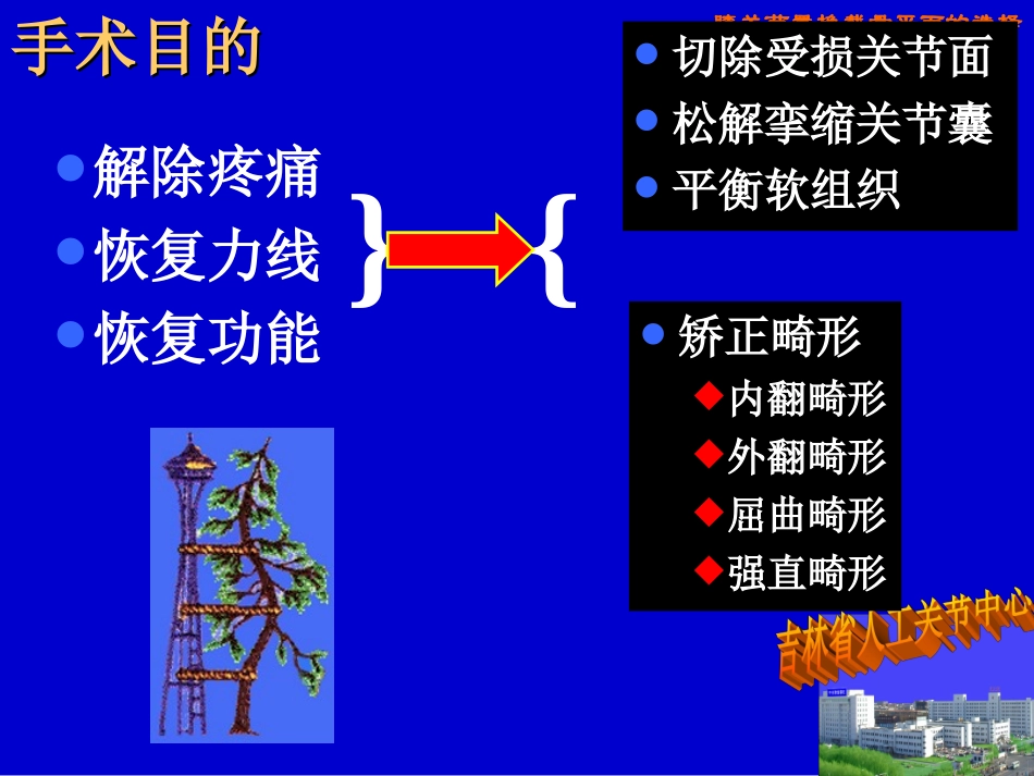 膝关节置换截骨面的决定.ppt_第2页