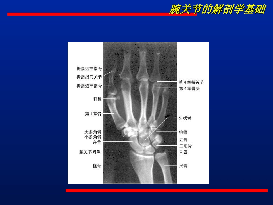 腕关节不稳的诊治.ppt_第3页