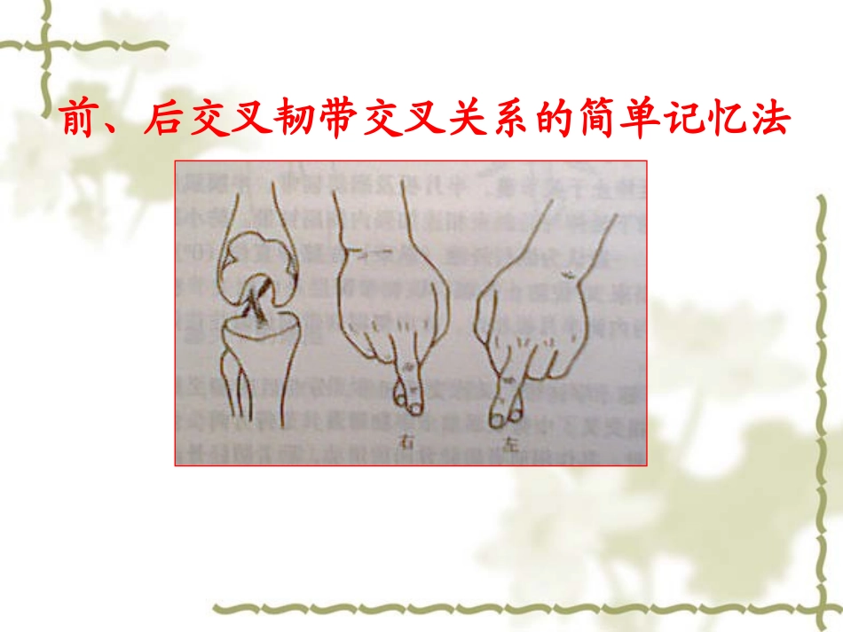 膝关节前交叉韧带损伤2.ppt_第3页