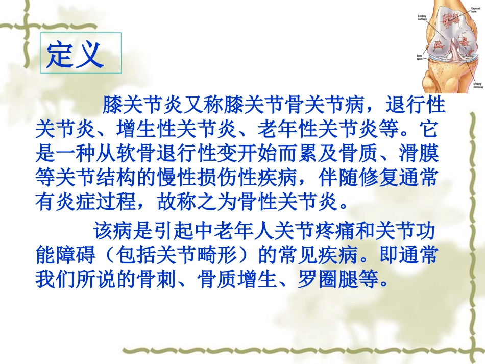 膝关节骨性关节炎.ppt_第2页