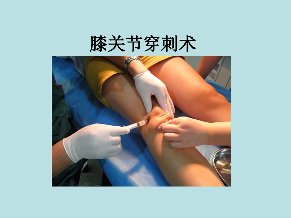 膝关节穿刺术.ppt_第1页
