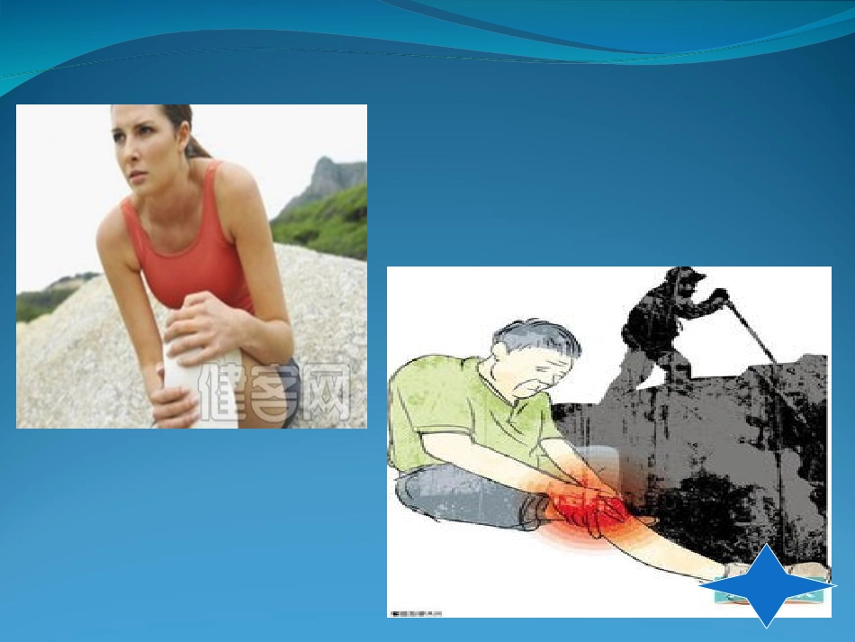 膝骨关节炎诊疗6.21.ppt_第3页